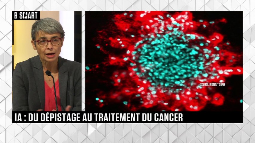 IA : du dépistage au traitement du cancer 