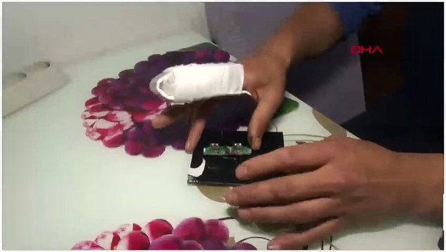 Taşınabilir şarj cihazı patladı, parmağı koptu