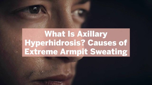 What Is Axillary Hyperhidrosis? Causes of Extreme Armpit Sweating—and Possible Solutions