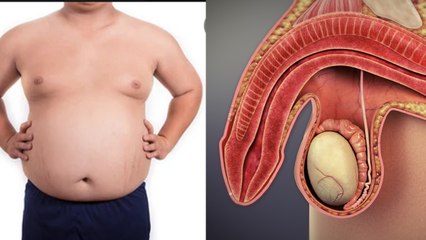 मर्दों में Testosterone की कमी के Symptoms चौंका देंगे, Body Effect खतरनाक | Boldsky