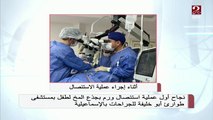 تفاصيل نجاح أول عملية استئصال ورم بجذع المخ لطفل بمستشفى طوارئ أبو خليفة للجراحات بالإسماعيلية