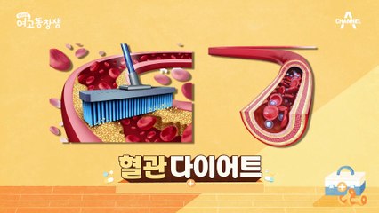 나의 혈관 건강을 자가 검진을 통해 알아본다? 비만 잡고 혈관 건강 지키는 방법!