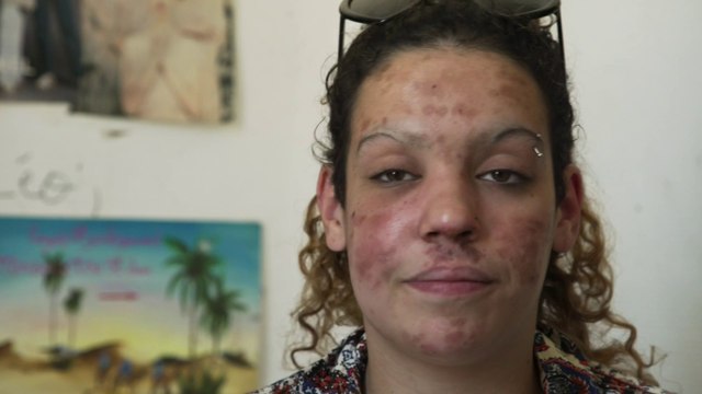 Crack, l'enfer de la drogue : comment une accro s'est métamorphosée à cause de sa consommation