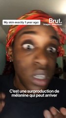 Comment en finir avec les taches ?