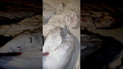 Burrowing With Hurt Nose Leaves Sheets Bloody