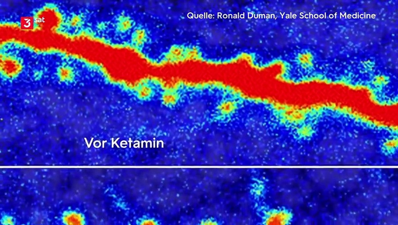 Neustart fürs Gehirn Wege aus der Depression
