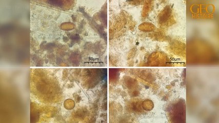 Nouvelle-Angleterre : il y a 200 ans, le ver solitaire frappait aussi les intestins des bourgeois