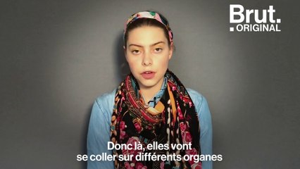 La réalité de l'endométriose, c'est ça