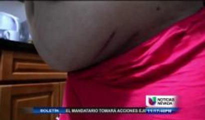Madre de cinco meses de embarazo dice fue golpeada por la policía