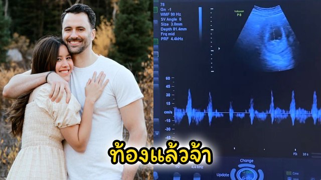 หญิง พลอยชมพู น้องสาวกอล์ฟ-ไมค์ ประกาศข่าวดีเบบี๋มาแล้วจ้า