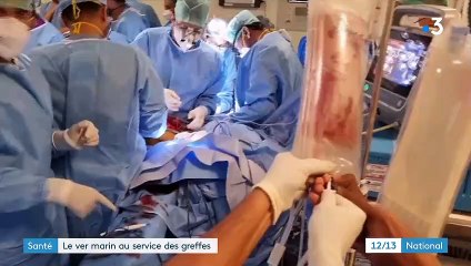 Santé : un ver marin au service des greffes