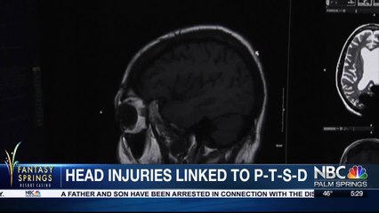 YOUR HEALTH TODAY: Brain injury linked to P-T-S-D