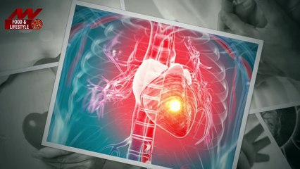 What is Silent Heart Attack? What are the main symptoms?