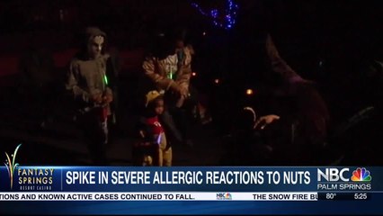 YOUR HEALTH TODAY: Nut Allergy Symptoms