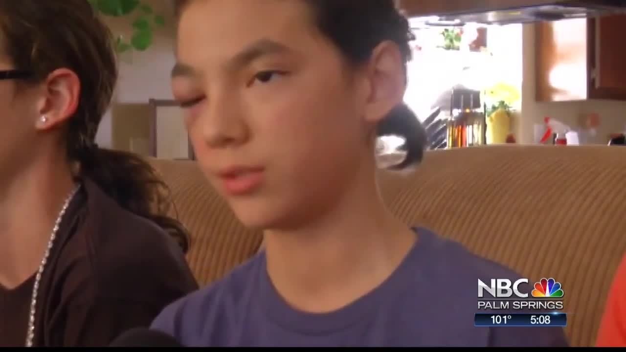 DA Requests More Information On Alleged Student Assault In Palm Springs