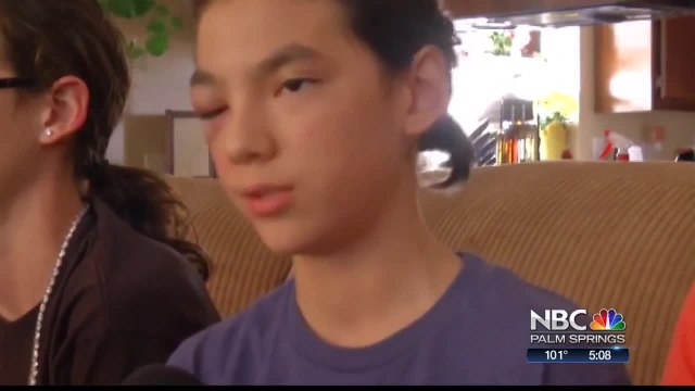 DA Requests More Information On Alleged Student Assault In Palm Springs