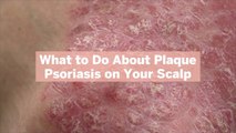 What to Do About Plaque Psoriasis on Your Scalp: Dermatologist-Recommended Treatments