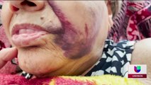 Mujer salvadoreña fue brutalmente atacada en Prince George's