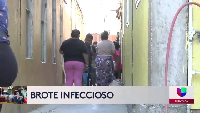 Registran brote de varicela en albergue para migrantes en Tijuana
