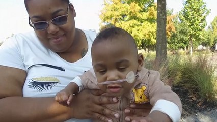 Curtis Means Dinobatkan sebagai Bayi Paling Prematur di Dunia