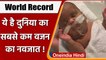 World Premature Baby: बच्चे के जिंदा बचने की कहानी, जिसने 21 हफ्तों में लिया जन्म | वनइंडिया हिंदी