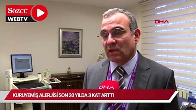 Kuruyemiş alerjisi son 20 yılda 3 kat arttı