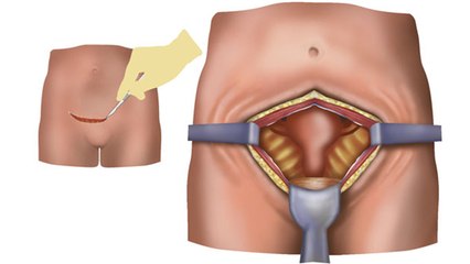 Uterus TB के Symptoms चौंकाने वाले, एक से दूसरी महिला में कैसे फैलती है ये बीमारी | Boldsky