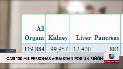 Pérez-Transplante Riñón