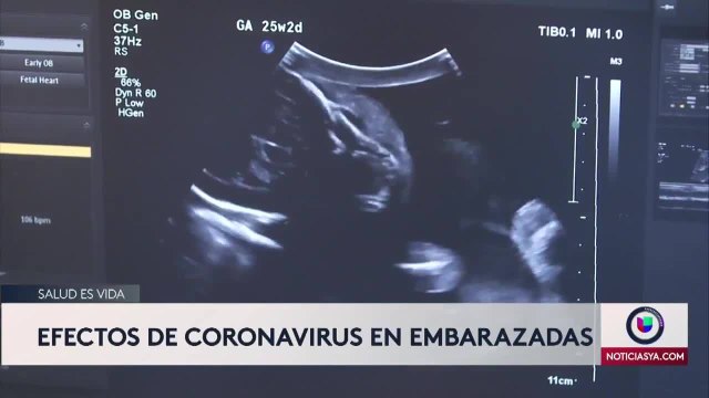 Noticias Orlando 6pm 051320 - SALUD ES VIDA