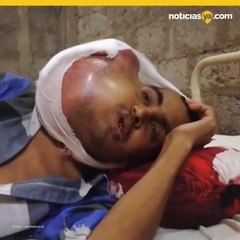 Joven tiene enorme tumor tras visitar a un dentista charlatn