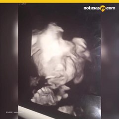 “Bebé demonio” abre los ojos y sonríe en ultrasonido de 24 semanas