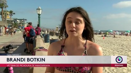 Picaduras de Matarratas en Playas de San Diego