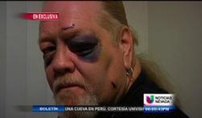 Víctima de un brutal ataque habla ante las cámaras