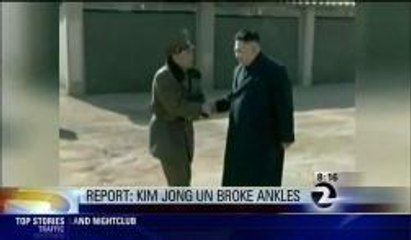 Kim Jong-un Broken Ankles
