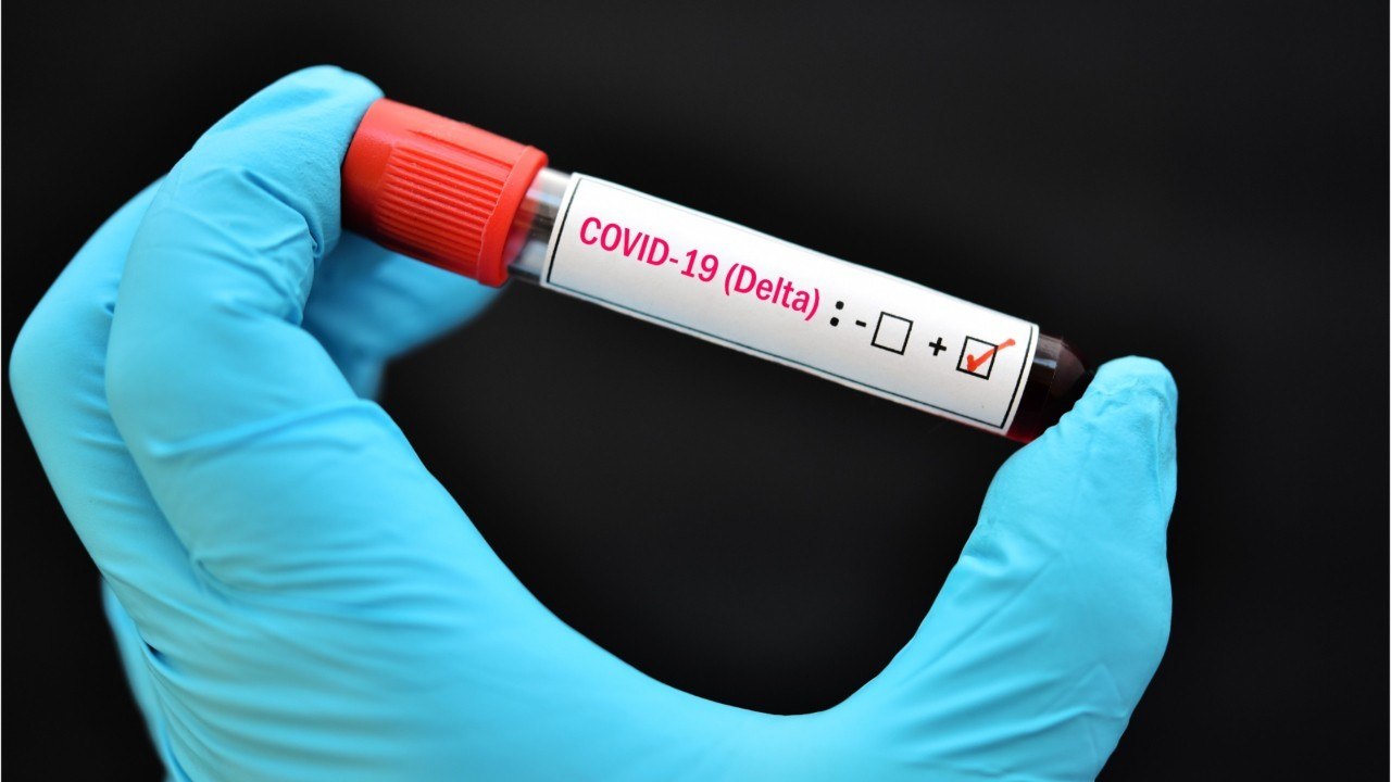 Le variant Delta va stopper la baisse des hospitalisations selon l'Institut Pasteur