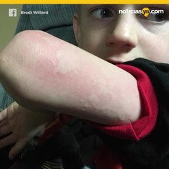 Este es el síntoma de la gripe que no conocías