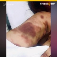Ataca brutalmente a mujer que conoci en redes sociales