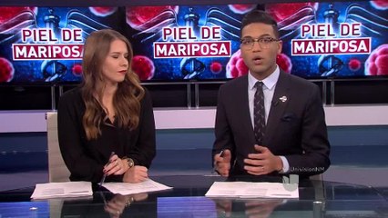 BELENSMOLE PIEL DE MARIPOSA