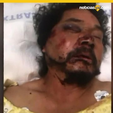 Atacan a un vendedor de frutas