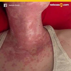 Toallitas Neutrogina