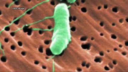 Sarasota: Tercera víctima mortal de bacteria Vibrio Vulnificus