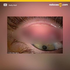 Casi pierde la vista al pasar 25 años sin desmaquillar sus ojos