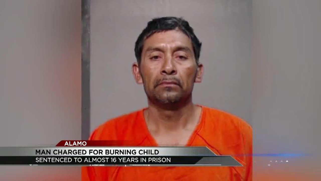man burns child