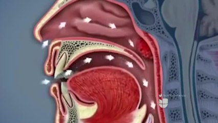 Inhalar condones, el nuevo reto entre los jóvenes