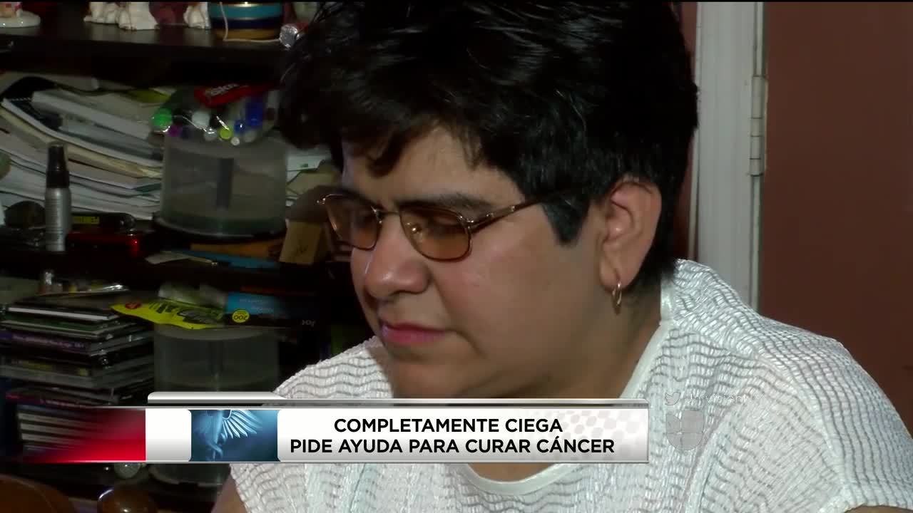 mayra pkg CGS