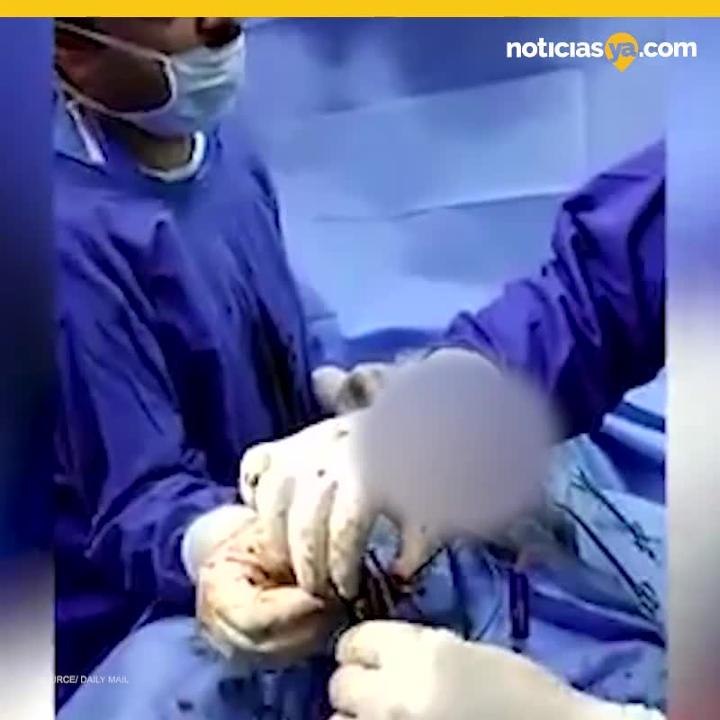 clavos estomago