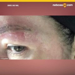 Infeccion por tratamiento para las cejas