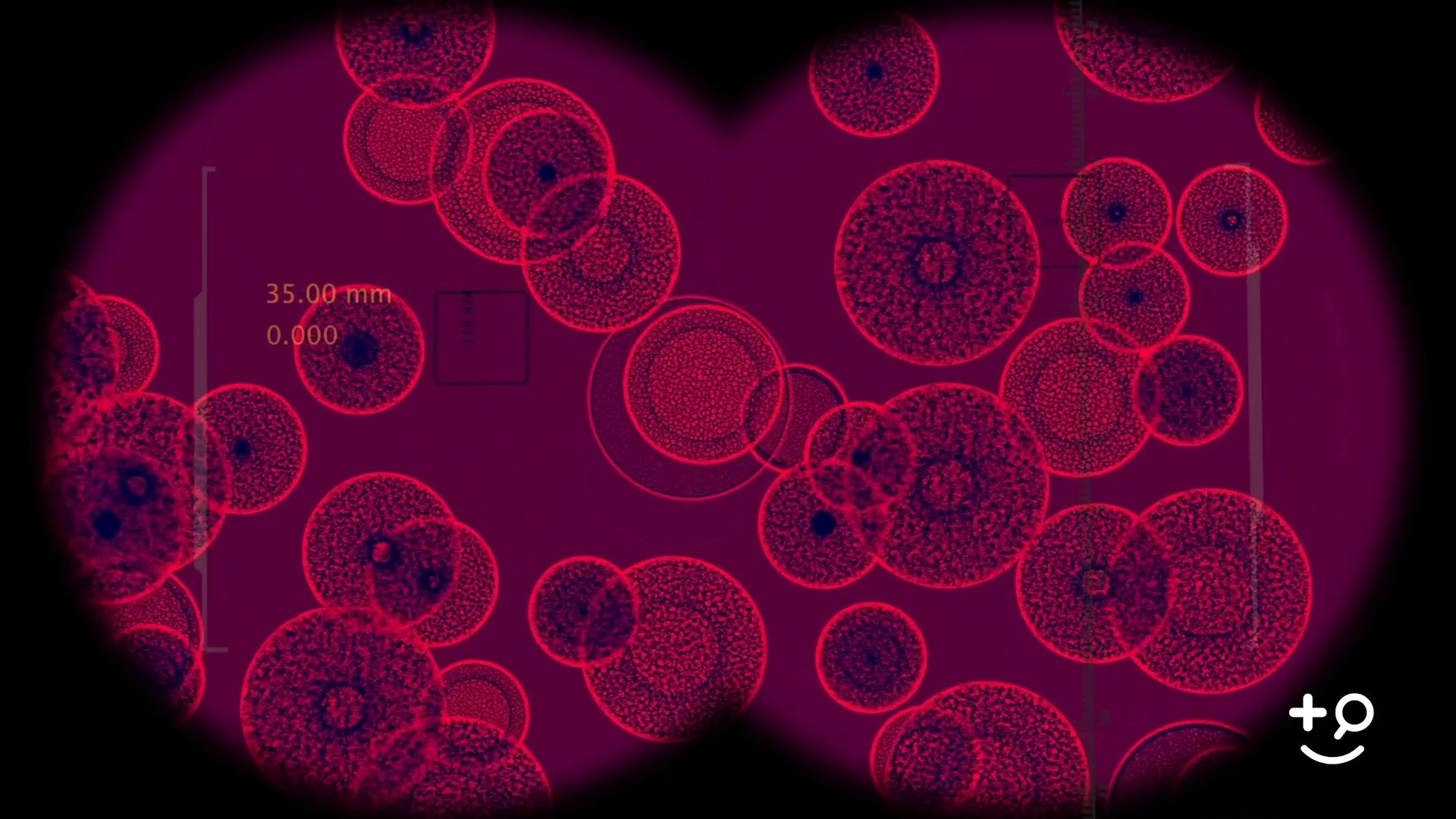 ⁣Leukemia - Overview