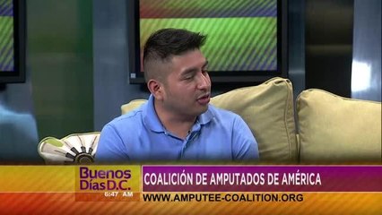 La Coalición de Amputados de América y su labor con los niños