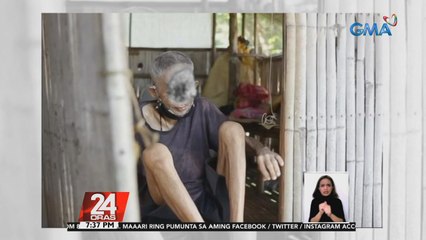 63-anyos na lalaki, nasira ang mukha dahil sa hinihinalang cancer sa balat | 24 Oras